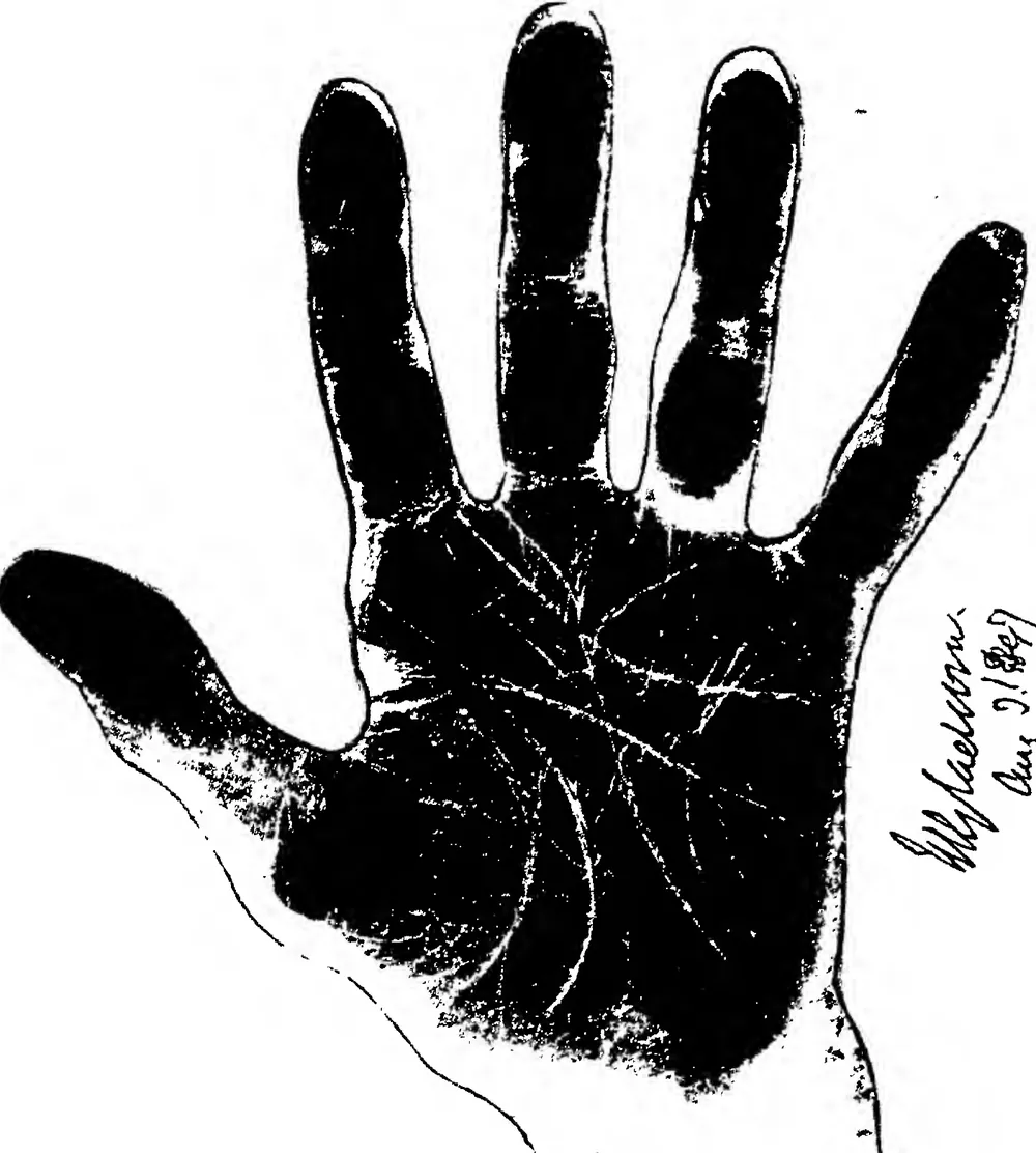 The Hand of William Ewart Gladstone