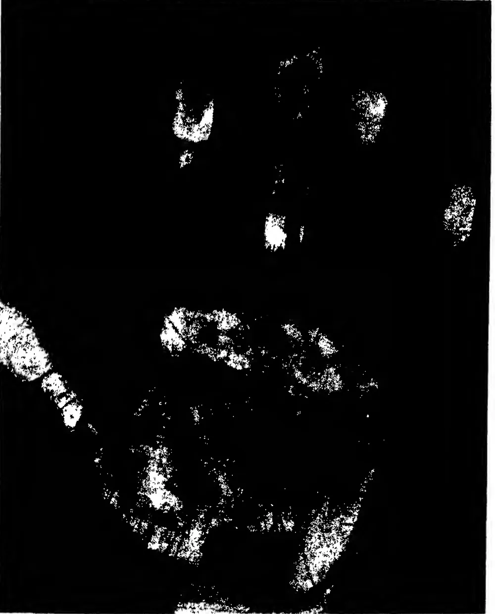 The Hand of a Murderer (Dr. Meyer)