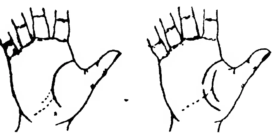 Fig 18. Fig 19. the Line of Life