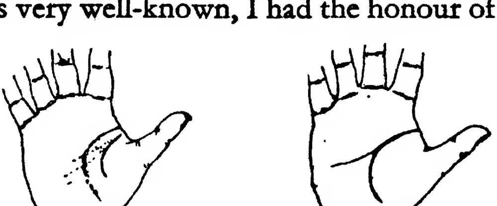 Fig 20. Fig 21. the Line of Life