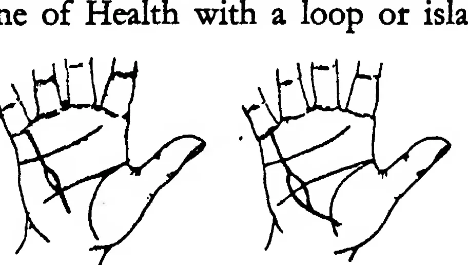 Fig 25. Fig 26. the Line of Health