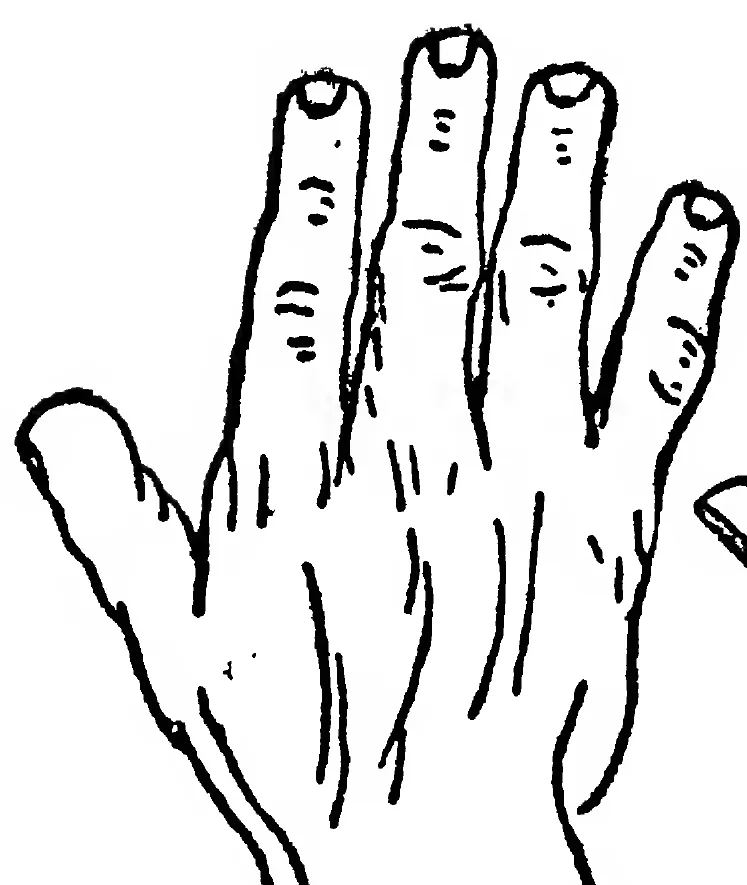 Fig. 30. the Elementary Hand