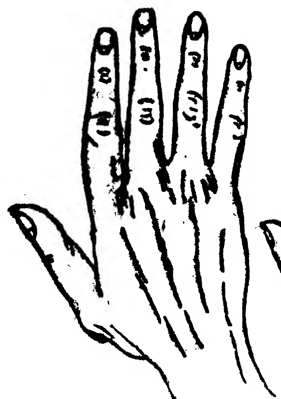 Fig. 34. the Conic or Artistic Hand