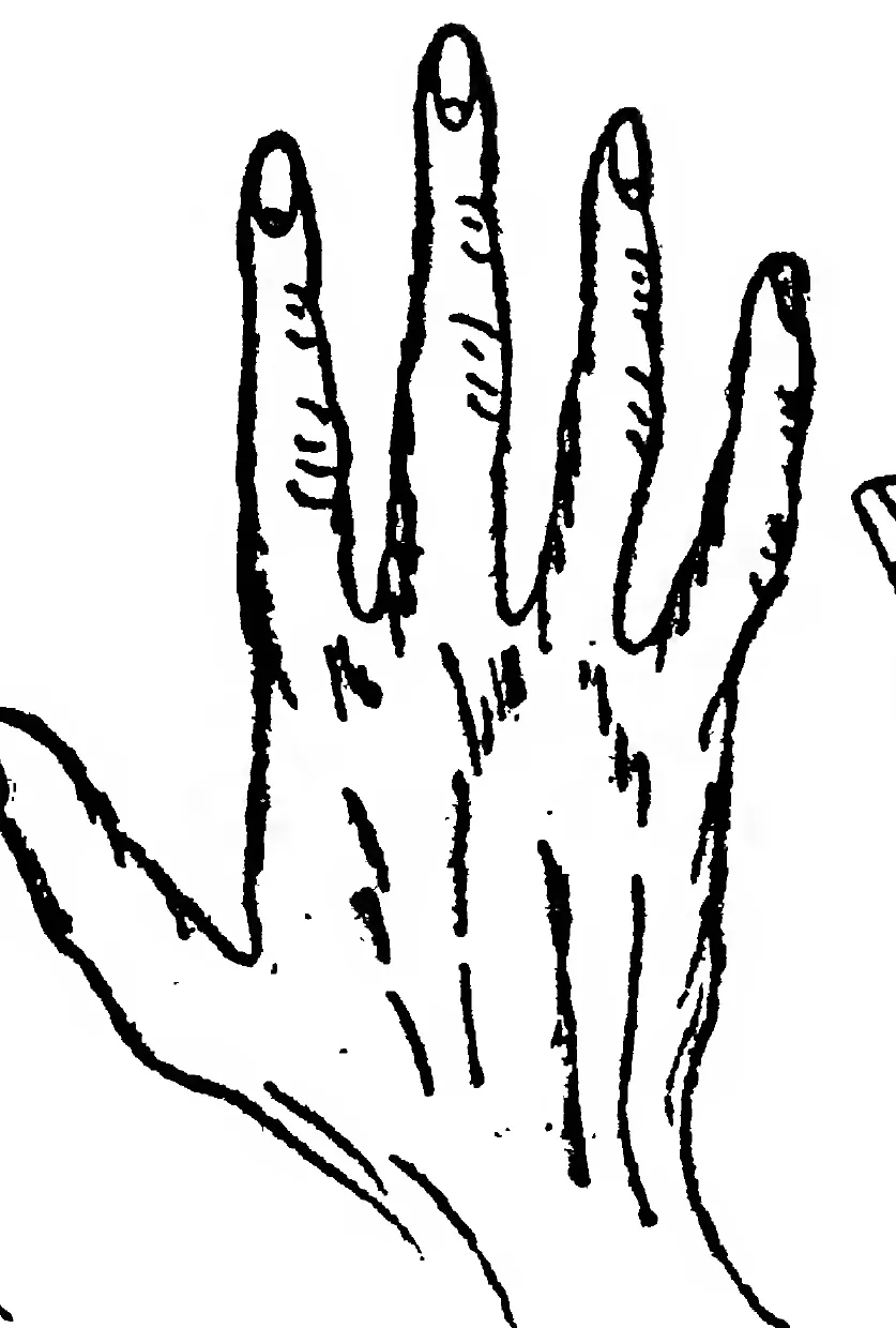 Fig. 35. the Psychic or Idealistic Hand