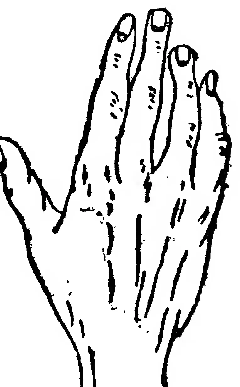 Fig. 36. the Mixed Hand