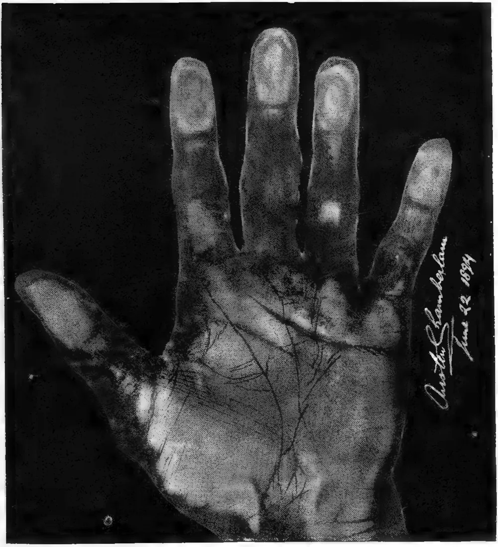 THE RIGHT HON. AUSTEN CHAMBERLAIN, M.P. Example of Heredity—see plate showing the lines on Mr. Joseph Chamberlain’s hand