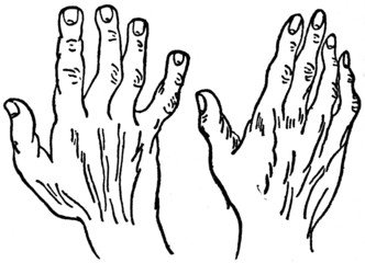 Fig. 3—THE SPATULATE HAND. Fig. 4—THE PHILOSOPHIC HAND.